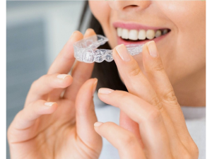 Clear aligners in Gurgaon