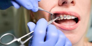 Orthodontist in Gurgaon