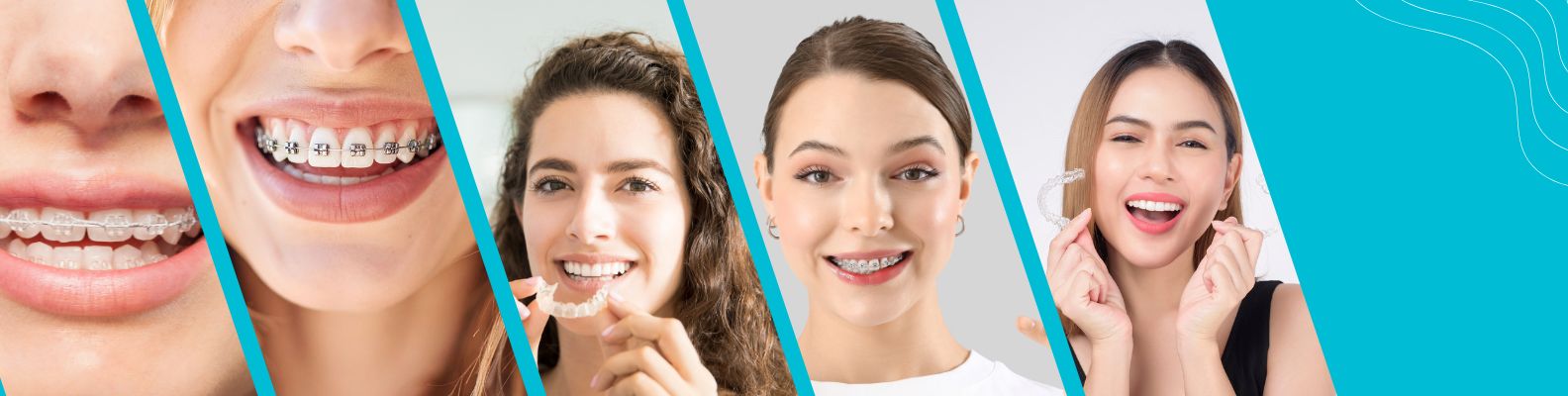 Orthodontics in Gurgaon