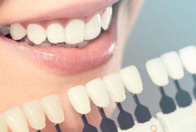 Cosmetic Dentist in Gurgaon