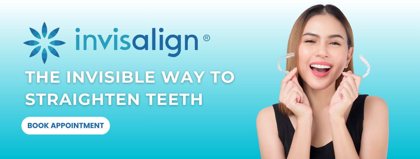 invisalign