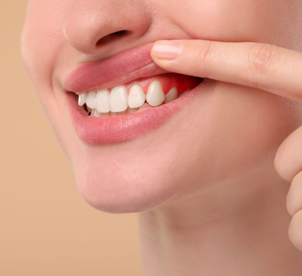 Periodontal treatment