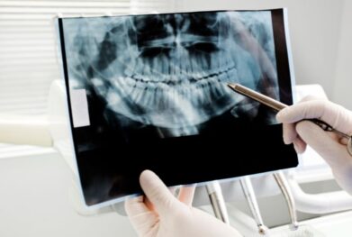 Digital OPG in gurgaon