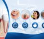 Dental Implants in Gurgaon 90x80
