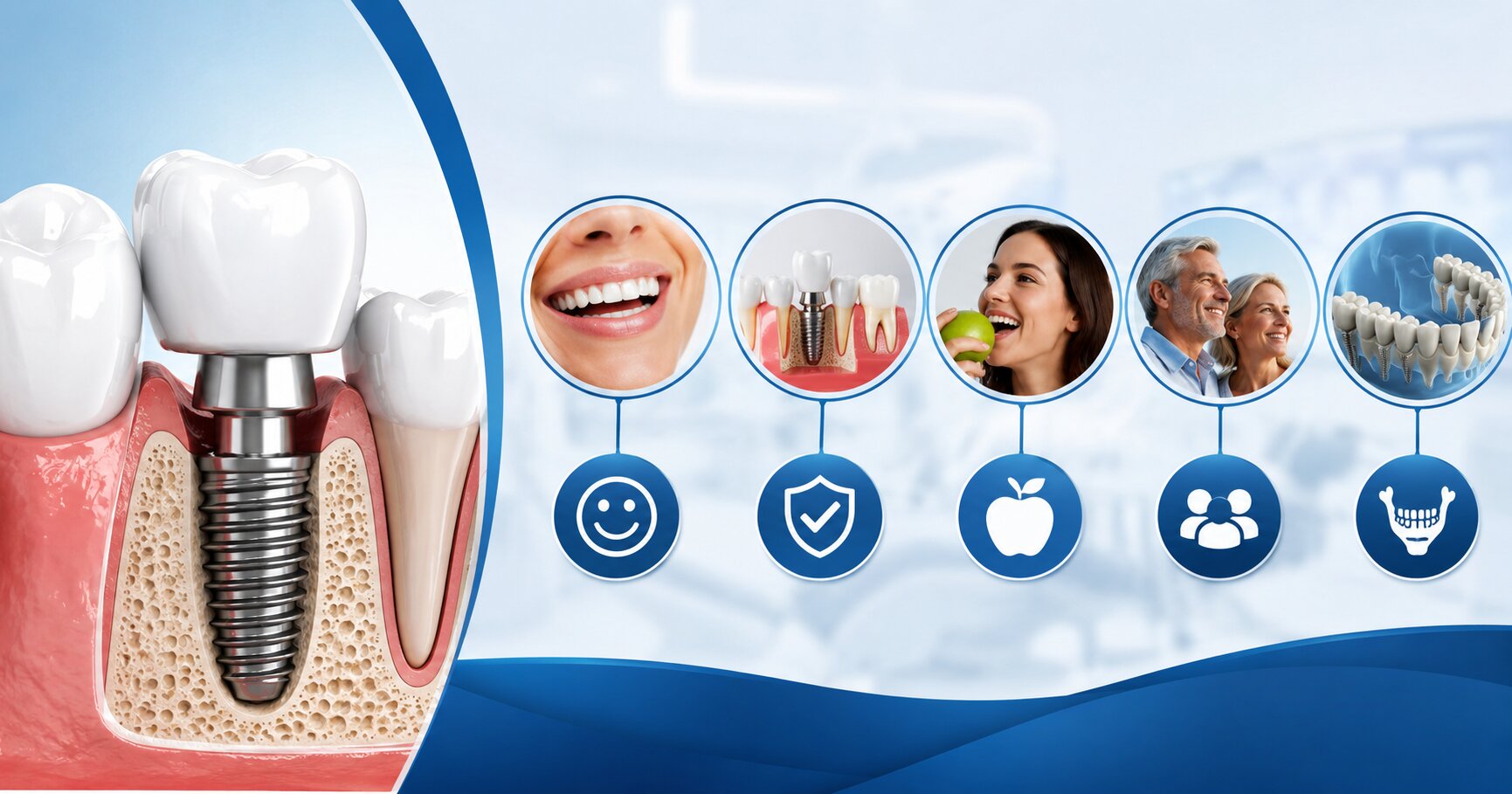 Dental Implants in Gurgaon