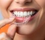 Invisible Braces 90x80