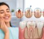 Root Canal Treatment 90x80