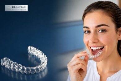 Clear Aligners