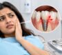 Dental implant 90x80