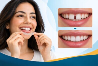 Can Invisalign Close Large Gaps Between Your Teeth?