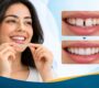 Invisalign in gurgaon 90x80